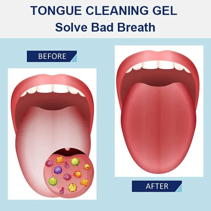 Probiotic Tongue Cleaning Gel Set