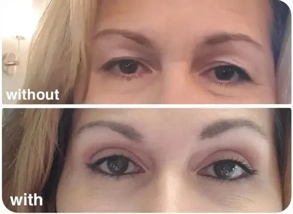 LiftMagic™ - Natural Invisible Upper EyeLid-Lifting Strips