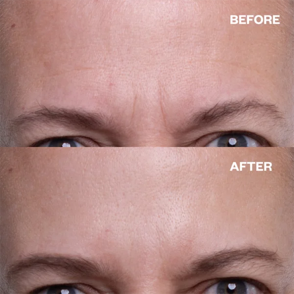 AgeDefy™ - Anti-Wrinkle Face Patches