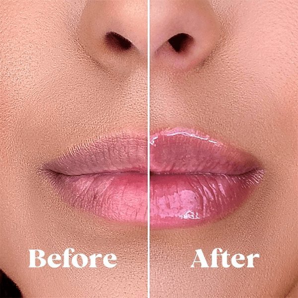 Derol oil™ - Fuller lips in 3 minutes